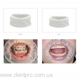 Ретрактор эластичный типа ОптраГейт (ZT Dental Cheek Retractor)
